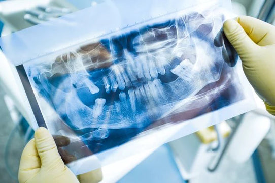 Stor interesse for Lumoral blandt svenske parodontologer og implantologer